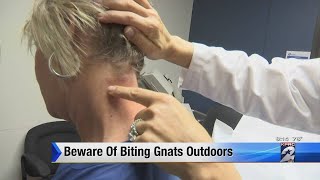 Beware of biting gnats outdoors [upl. by Anear447]