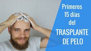 TRASPLANTE DE PELO  ¿QUÉ HACER LOS PRIMEROS DÍAS ¿QUÉ PUEDES SUFRIR [upl. by Teodora129]