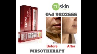 Filorga NCTF Mesotherapy [upl. by Desi882]