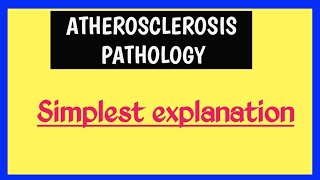 Atherosclerosis  Pathophysiology [upl. by Alicia888]