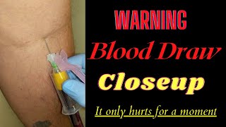 Warning Closeup Blood Draw it only hurts for a moment [upl. by Rosenwald259]