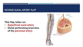 Superolateral Knee Injection Guide [upl. by Barkley]