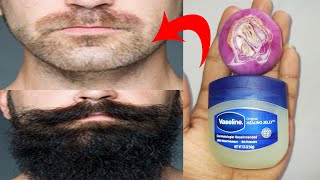 How to grow beard faster naturally at home with onion and vaseline  Beard growth oil [upl. by Weingarten]