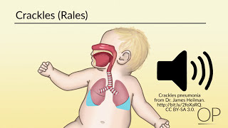 Respiratory Assessment by B Leary L DelSignore  OPENPediatrics [upl. by Needan330]