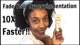 How To REALLY Use Ambi Fade Cream  Fade Hyperpigmentation [upl. by Sutsugua]