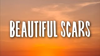 Maximillian  Beautiful Scars Lyrics [upl. by Kinata]