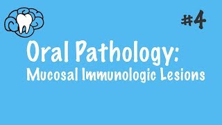 Oral Pathology  Mucosal Immunologic Diseases  INBDE ADAT [upl. by Eidualc]