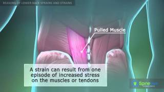 Lower Back Sprain and Strain Reasons [upl. by Machos]