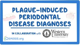 Polycythemia vera  causes symptoms diagnosis treatment pathology [upl. by Dugan]