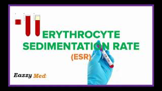 Erythrocyte Sedimentation Rate ESR Made Simple [upl. by Marianna]