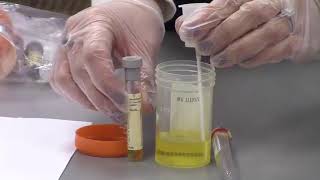 Urine Specimen Collection [upl. by Barthol]