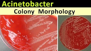 Acinetobacter Colony Morphology [upl. by Leribag]