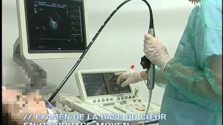 Echographie Thyroidienne Nouvelle Classification Dr JYacoubi [upl. by Ibrab]