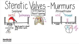 Heart Murmurs and Valve Disease Heart Murmur Series [upl. by Neeoma]