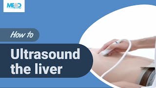 How to ultrasound the liver [upl. by Yekcaj]