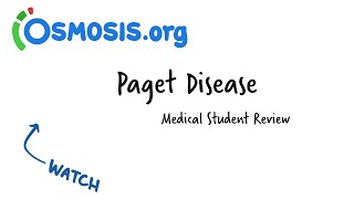 Paget Disease Osmosis Study Video [upl. by Bobbie]