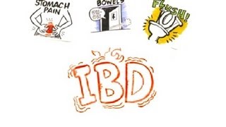 Inflammatory Bowel Disease IBD [upl. by Dippold]