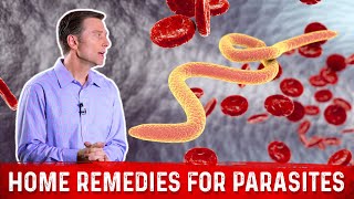 Best Home Remedies for Parasites – Dr Berg [upl. by Ijies]