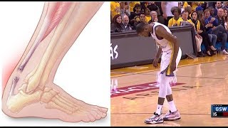 Kevin Durant Injured l Achilles or Calf  Rockets vs Warriors [upl. by Vedis]