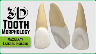 Corrective Jaw Orthognathic Surgery Animation [upl. by Yeuh]