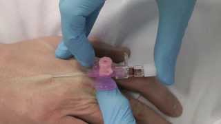 Cannulation How to gain IV access [upl. by Sibyls]