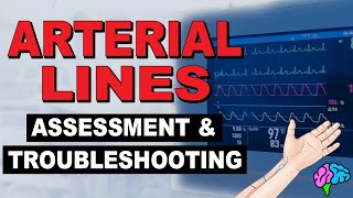 The Arterial Line Assessment amp Troubleshooting [upl. by Rolland]