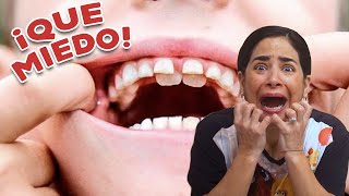 ¿Por qué NO se le Caen los Dientes a mi Hijo ¿QUÉ HACER [upl. by Retniw]