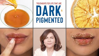 How To Treat DARK PIGMENTED Lips  Dermatologists Advice [upl. by Chapel467]