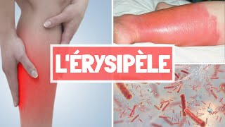 ÉRYSIPÈLE  CAUSES  SYPMTOMES  COMPLICATIONS  TRAITEMENT [upl. by Naujek]