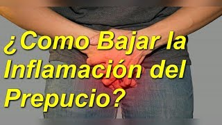 5 🖐TRATAMIENTOS 😀NATURALES para el PREPUCIO  👀SI SE PUEDE BAJAR LA INFLAMACIÓN👈 [upl. by Herald]