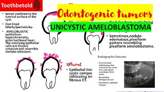 Unicystic ameloblastoma  Odontogenic tumors Oral pathology  Ameloblastoma [upl. by Yelrebmik435]