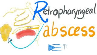 Retropharyngeal Abscess [upl. by Brace]