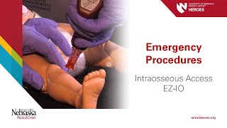 Emergency Procedures Intraosseous Access  EZIO [upl. by Coreen]