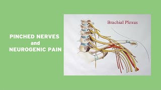 Lumbar Spinal Stenosis Symptoms Neurogenic Claudicatiion [upl. by Eninotna814]