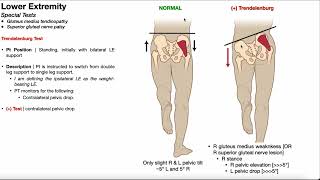 Trendelenburg Test  Rationale amp Interpretation [upl. by Jodi]