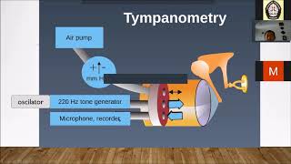 Timpanometri [upl. by Eenitsed]