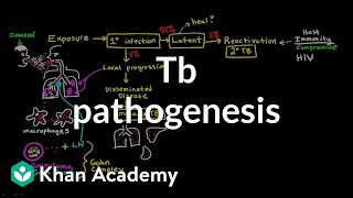 TB pathogenesis  Infectious diseases  NCLEXRN  Khan Academy [upl. by Justen325]