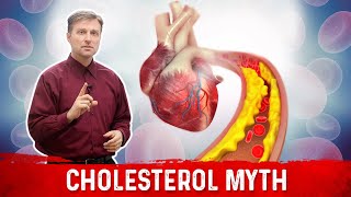 The Cholesterol Myths amp Facts [upl. by Eisinger]