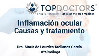 Inflamación ocular causas y tratamiento [upl. by Tinaret]