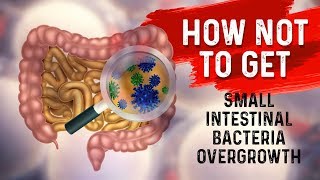 How to STOP Small Intestine Bacterial OvergrowthSIBO – Dr Berg [upl. by Zadack]