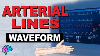 The Arterial Line Waveform EXPLAINED [upl. by Gwenora]