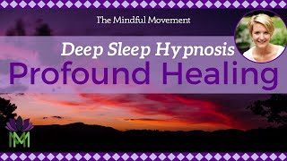 Use Your Powerful Mind Healing Deep Sleep Hypnosis  Mindful Movement [upl. by Eirok841]