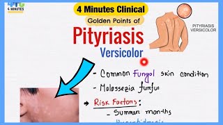 Pityriasis Versicolor Explained Like Water  Symptoms Pathogenesis Treatment  4 Minutes Clinical [upl. by Adlitam]