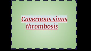 Cavernous sinus Thrombosis [upl. by Rivers]