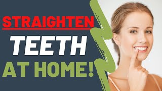 Straighten Your Teeth At Home NATURALLY  Dentist UPDATED 2021 [upl. by Nythsa]