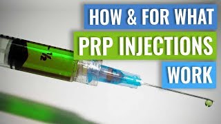 How do PRP injections work [upl. by Harmonia]