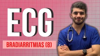 ELECTROCARDIOGRAMA  Bradiarritmias 8 EXPLICADO FÁCIL [upl. by Felizio]