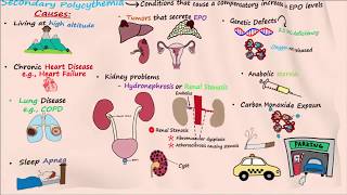 Polycythemia  Part 2 [upl. by Comptom]