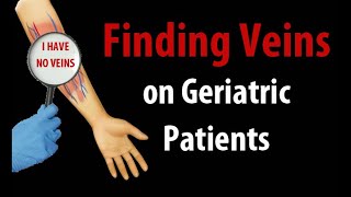 Help I Cant Find Veins on Geriatric Patients [upl. by Didier]