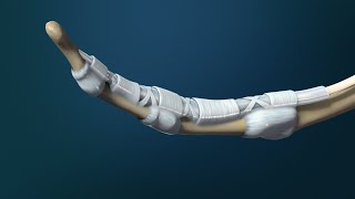 Flexor Tendon Injuries [upl. by Anohs533]